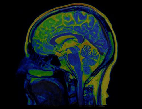 Biomarkers identified in collegiate athletes that could help predict time needed to recover from concussion